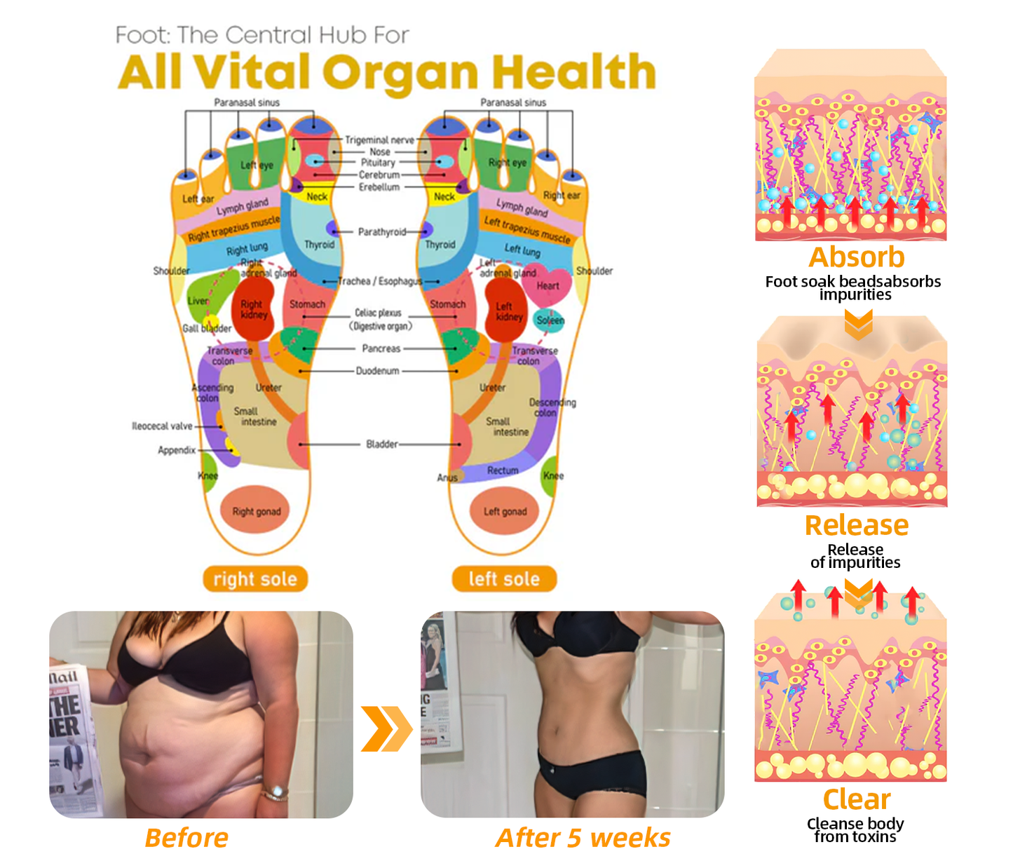 𝟑𝟎 𝐇𝐞𝐫𝐛𝐚𝐥 𝐋𝐲𝐦𝐩𝐡𝐚𝐭𝐢𝐜 𝐃𝐫𝐚𝐢𝐧𝐚𝐠𝐞 𝐖𝐞𝐢𝐠𝐡𝐭 𝐋𝐨𝐬𝐬 𝐁𝐞𝐚𝐝𝐬-👨‍⚕️👨‍⚕️𝗥𝗲𝗰𝗼𝗺𝗺𝗲𝗻𝗱𝗲𝗱 𝗯𝘆 𝘁𝗵𝗲 𝗕𝗿𝗶𝘁𝗶𝘀𝗵 𝗟𝘆𝗺𝗽𝗵𝗮𝘁𝗶𝗰 𝗦𝗼𝗰𝗶𝗲𝘁𝘆 (𝗟𝗦𝗡)