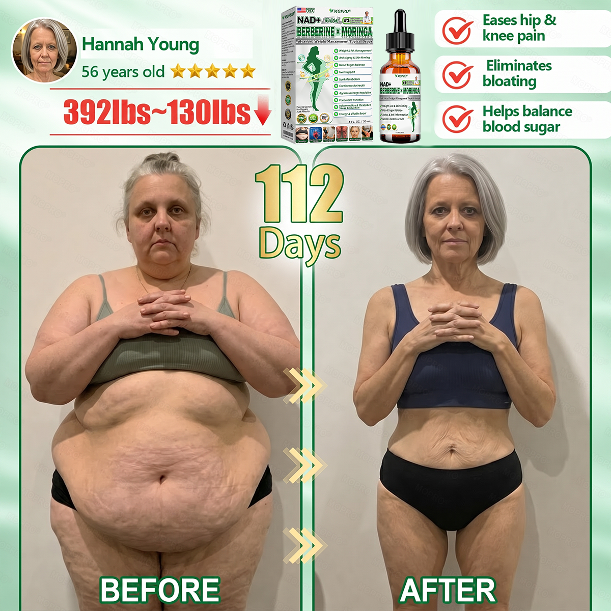 【𝟐𝟎𝟐𝟔 𝐍𝐞𝐰 𝐔𝐩𝐠𝐫𝐚𝐝𝐞: 𝟖𝟎% 𝐎𝐅𝐅】🌱 𝐌𝗢𝑷𝙍𝙊®𝐀𝐝𝐯𝐚𝐧𝐜𝐞𝐝 𝐖𝐞𝐢𝐠𝐡𝐭 𝐌𝐚𝐧𝐚𝐠𝐞𝐦𝐞𝐧𝐭 𝐓𝐨𝐩𝐢𝐜𝐚𝐥 𝐃𝐫𝐨𝐩𝐬 — 𝘄𝗶𝘁𝗵 𝗕𝗲𝗿𝗯𝗲𝗿𝗶𝗻𝗲 & 𝗟𝗶𝗽𝗼𝗹𝘆𝘁𝗶𝗰 𝗣𝗲𝗽𝘁𝗶𝗱𝗲 𝗖𝗼𝗺𝗽𝗹𝗲𝘅 𝗳𝗼𝗿 Detox Metabolism,𝐰𝐞𝐢𝐠𝐡𝐭 𝐦𝐚𝐧𝐚𝐠𝐞𝐦𝐞𝐧𝐭, 𝐒𝐤𝐢𝐧 𝐅𝐢𝐫𝐦𝐢𝐧𝐠,𝐛𝐥𝐨𝐨𝐝 𝐬𝐮𝐠𝐚𝐫 𝐛𝐚𝐥𝐚𝐧𝐜𝐞 & 𝐡𝐞𝐚𝐫𝐭 𝐡𝐞𝐚𝐥𝐭𝐡 𝐬𝐮𝐩𝐩𝐨𝐫𝐭🌱