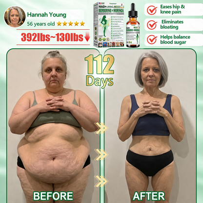 【𝟐𝟎𝟐𝟔 𝐍𝐞𝐰 𝐔𝐩𝐠𝐫𝐚𝐝𝐞: 𝟖𝟎% 𝐎𝐅𝐅】🌱 𝐌𝗢𝑷𝙍𝙊®𝐀𝐝𝐯𝐚𝐧𝐜𝐞𝐝 𝐖𝐞𝐢𝐠𝐡𝐭 𝐌𝐚𝐧𝐚𝐠𝐞𝐦𝐞𝐧𝐭 𝐓𝐨𝐩𝐢𝐜𝐚𝐥 𝐃𝐫𝐨𝐩𝐬 — 𝘄𝗶𝘁𝗵 𝗕𝗲𝗿𝗯𝗲𝗿𝗶𝗻𝗲 & 𝗟𝗶𝗽𝗼𝗹𝘆𝘁𝗶𝗰 𝗣𝗲𝗽𝘁𝗶𝗱𝗲 𝗖𝗼𝗺𝗽𝗹𝗲𝘅 𝗳𝗼𝗿 Detox Metabolism,𝐰𝐞𝐢𝐠𝐡𝐭 𝐦𝐚𝐧𝐚𝐠𝐞𝐦𝐞𝐧𝐭, 𝐒𝐤𝐢𝐧 𝐅𝐢𝐫𝐦𝐢𝐧𝐠,𝐛𝐥𝐨𝐨𝐝 𝐬𝐮𝐠𝐚𝐫 𝐛𝐚𝐥𝐚𝐧𝐜𝐞 & 𝐡𝐞𝐚𝐫𝐭 𝐡𝐞𝐚𝐥𝐭𝐡 𝐬𝐮𝐩𝐩𝐨𝐫𝐭🌱