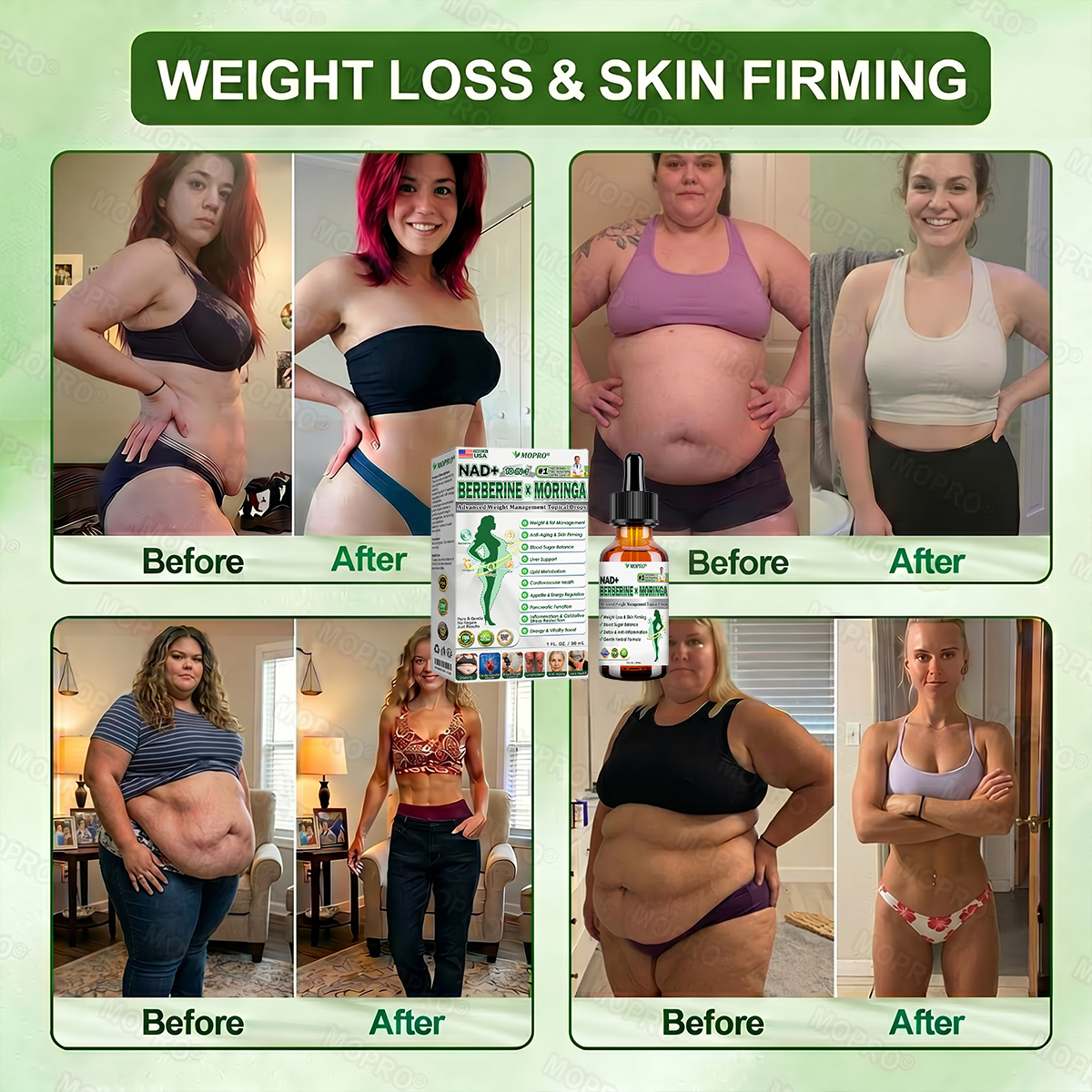【𝟐𝟎𝟐𝟔 𝐍𝐞𝐰 𝐔𝐩𝐠𝐫𝐚𝐝𝐞: 𝟖𝟎% 𝐎𝐅𝐅】🌱 𝐌𝗢𝑷𝙍𝙊®𝐀𝐝𝐯𝐚𝐧𝐜𝐞𝐝 𝐖𝐞𝐢𝐠𝐡𝐭 𝐌𝐚𝐧𝐚𝐠𝐞𝐦𝐞𝐧𝐭 𝐓𝐨𝐩𝐢𝐜𝐚𝐥 𝐃𝐫𝐨𝐩𝐬 — 𝘄𝗶𝘁𝗵 𝗕𝗲𝗿𝗯𝗲𝗿𝗶𝗻𝗲 & 𝗟𝗶𝗽𝗼𝗹𝘆𝘁𝗶𝗰 𝗣𝗲𝗽𝘁𝗶𝗱𝗲 𝗖𝗼𝗺𝗽𝗹𝗲𝘅 𝗳𝗼𝗿 Detox Metabolism,𝐰𝐞𝐢𝐠𝐡𝐭 𝐦𝐚𝐧𝐚𝐠𝐞𝐦𝐞𝐧𝐭, 𝐒𝐤𝐢𝐧 𝐅𝐢𝐫𝐦𝐢𝐧𝐠,𝐛𝐥𝐨𝐨𝐝 𝐬𝐮𝐠𝐚𝐫 𝐛𝐚𝐥𝐚𝐧𝐜𝐞 & 𝐡𝐞𝐚𝐫𝐭 𝐡𝐞𝐚𝐥𝐭𝐡 𝐬𝐮𝐩𝐩𝐨𝐫𝐭🌱